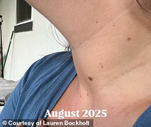 Casual TikTok Post Leads to Thyroid Diagnosis for Texas Woman