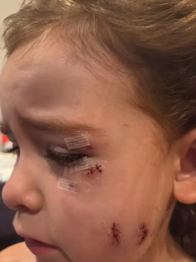 Two Mothers and Child Survive Harrowing Attack by American Bulldogs in Oshawa
