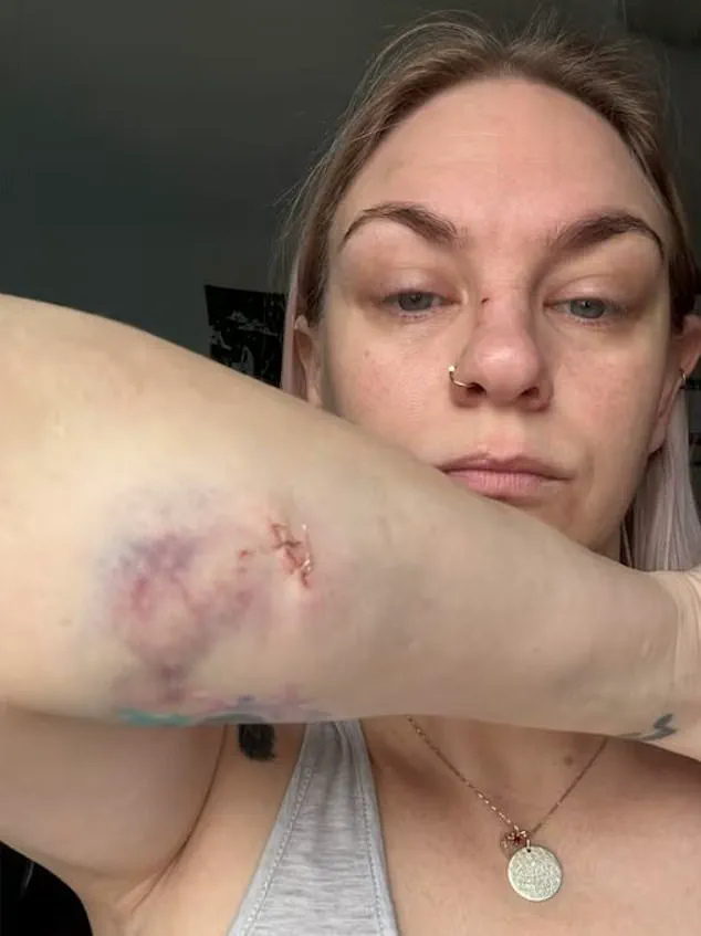 Two Mothers and Child Survive Harrowing Attack by American Bulldogs in Oshawa