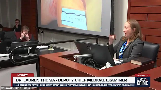 Paul Caneiro Breaks Down in Court as Medical Examiner Details Fatal Injuries in Tragedy